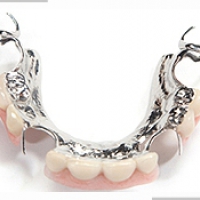 Dent Pour Dent Laboratoire De Prothèses Dentaires