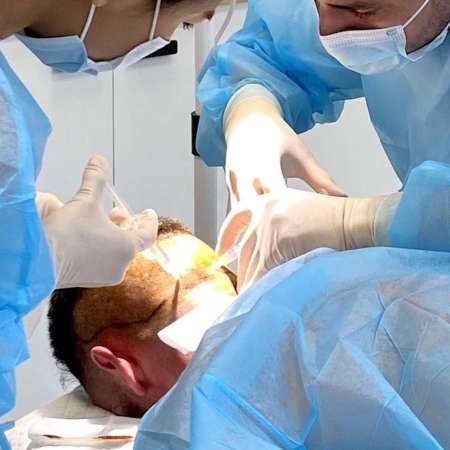 Alfa Hair Transplant Annecy-7 Centres Experts En Greffe De Cheveux Fue En Europe